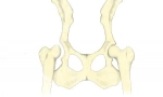 Wyświetlacze stawów biodrowych u psów: diagnoza, leczenie i prognozy