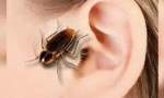 Tracakan w uchu: objawy i ekstrakcja