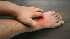 Alergia, aby ugryźć kwiat w człowieku