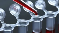 Badanie krwi na robaki u dzieci i dorosłych