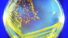 Nieśmiertelne zwierzęta, które przetrwają nas wszystkich