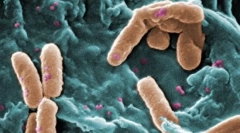 Co eukararyotes różnią się od prokariota?