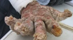 Co to jest niebezpieczna filioza: objawy i leczenie