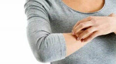 Niż niebezpieczne pchły dla człowieka?