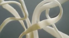 Jak niebezpieczne robaki wstążki u ludzi i ich objawów