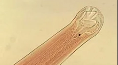 Co to jest ankilostom?