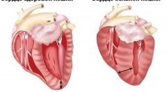 Czym jest kardiomiopatia przerostowa w kotach i co to jest niebezpieczne