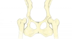 Wyświetlacze stawów biodrowych u psów: diagnoza, leczenie i prognozy