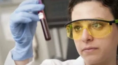 Jak przeprowadzany jest test krwi na toksoplazmozie