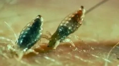 Jak wyglądają gryźć wszy?