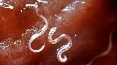 Jak żyje i rozwija się malaria plazmodium