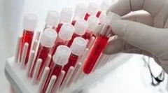 Jakie badania krwi na pasożytach muszą przejść?