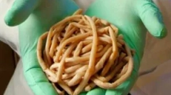 Jakie robaki mieszkają w ludzkim ciele