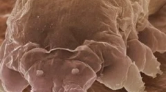 Demodex roztoczy i cechy jej źródeł utrzymania