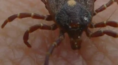 Magniczna erlihioza monocytarna