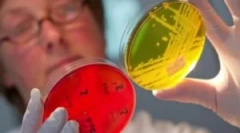 Leczenie enterobiozy u dzieci i dorosłych