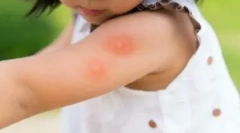 Najlepsze narzędzia z komarów dla dzieci