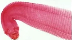 Najczęstsze rodzaje robaków u ludzi