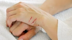 Dlaczego walka kotów