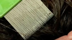 Procedura ukończenia wszy i nd