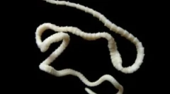 Szeroki lenthe u ludzie: leczenie i objawy