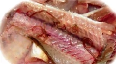 Objawy i leczenie opisorchozy