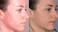 Środki do leczenia demodkicy