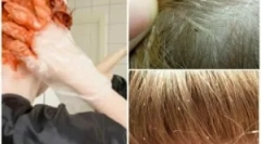 Czy wszy farba do włosów zabija?