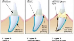 Domowej roboty pielęgnacja drapieżnika - czyszczenie catticka