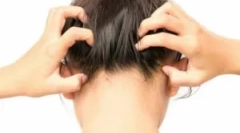 Rodzaje pasożytniczych owadów w głowie mężczyzny