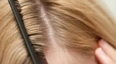 Rodzaje wszy u ludzi