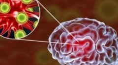 Wirusowe zapalenie mózgu mózgu: gatunki i objawy