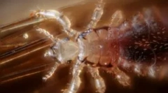 Wszy jak przewoźnicy choroby