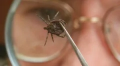 Infekcja człowieka z kleszczącym zapaleniem mózgu